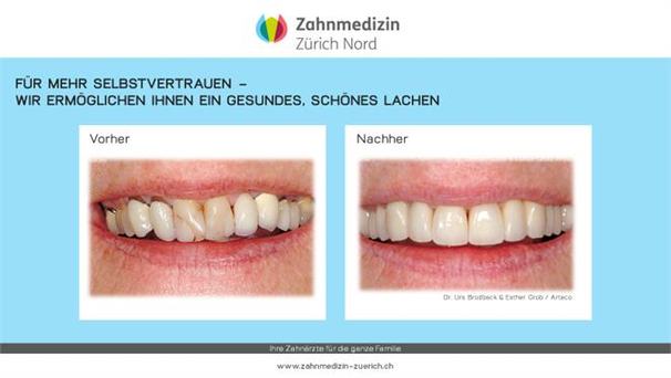 Geasmtsanierung_Vorher-Nachher_1.png 
